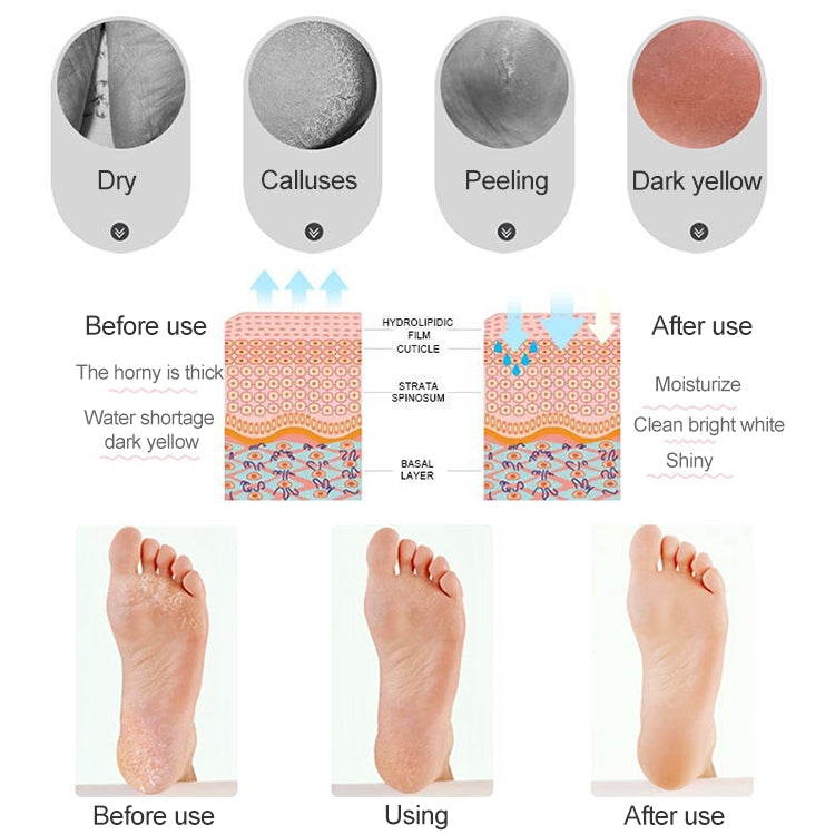 Silicone Sailboat Socks Foot Heel Anti-cracking Sleeve Anti-drying Beach Home Socks